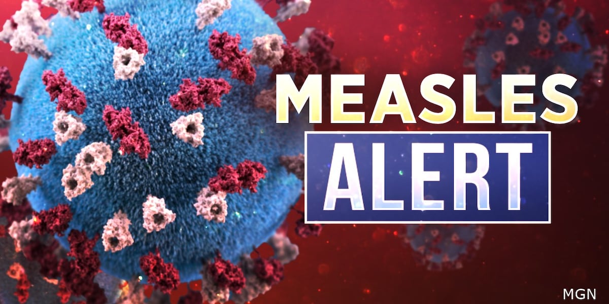 North Carolina reports first measles case of 2025; Health officials urge vigilance as travel season peaks