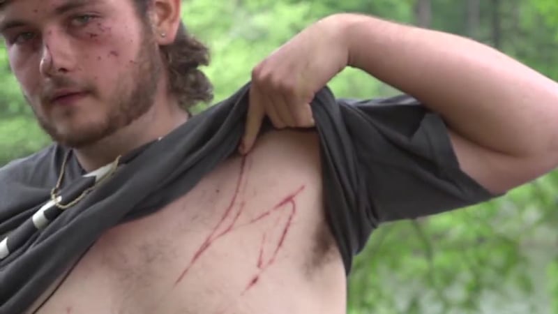 A 19-year-old who was struck by lightning while fishing was back in the same spot just 24...