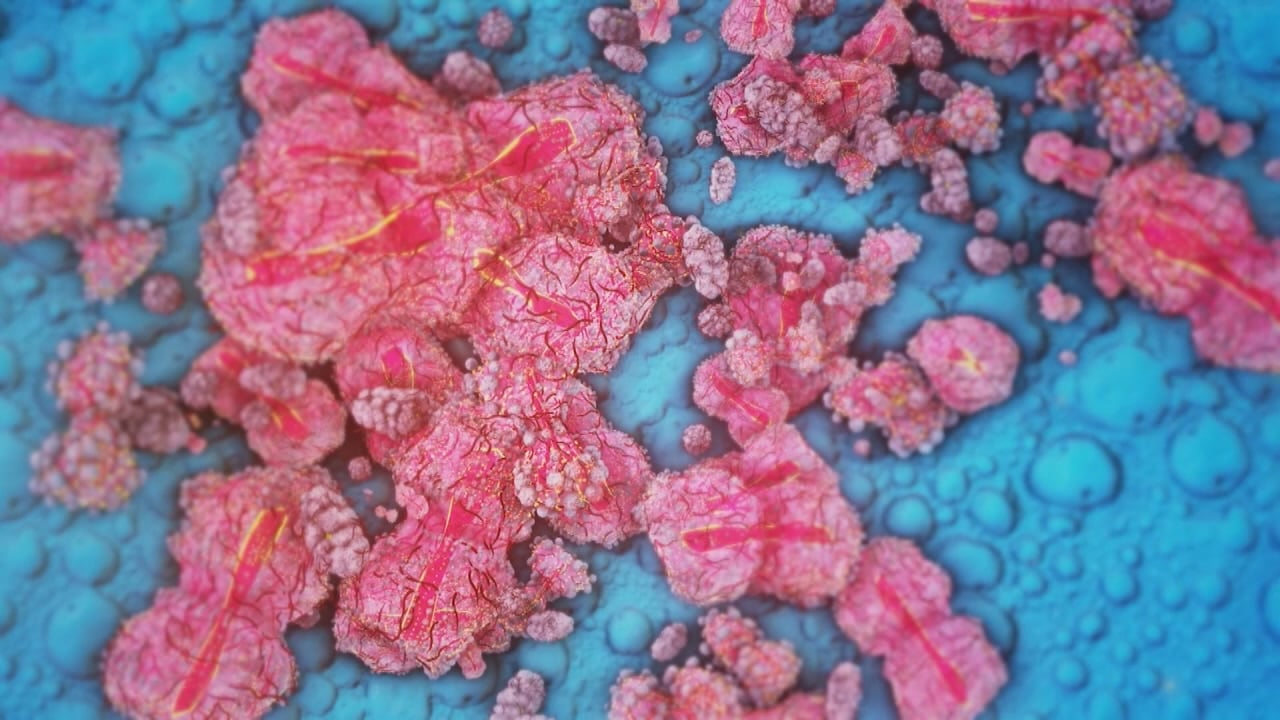 Mpox detected in Pitt County wastewater
