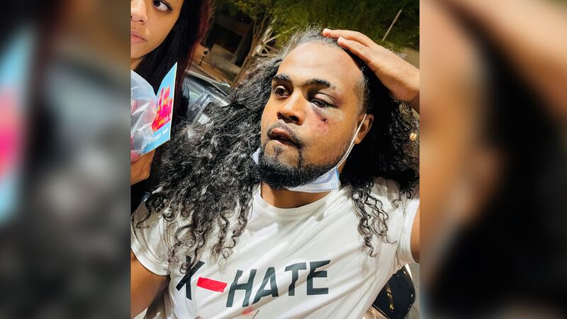 Denorver Garrett said he was protesting at Jefferson Square Park when he was punched in the...