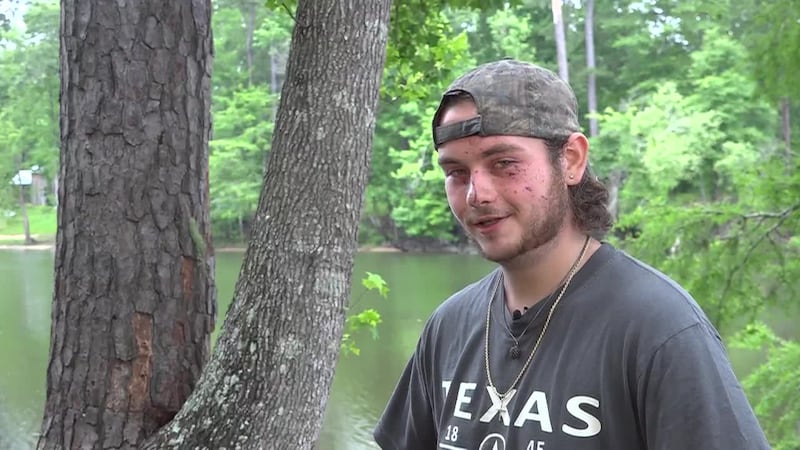 A 19-year-old who was struck by lightning while fishing was back in the same spot just 24...