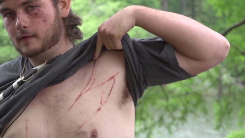 A 19-year-old who was struck by lightning while fishing was back in the same spot just 24...